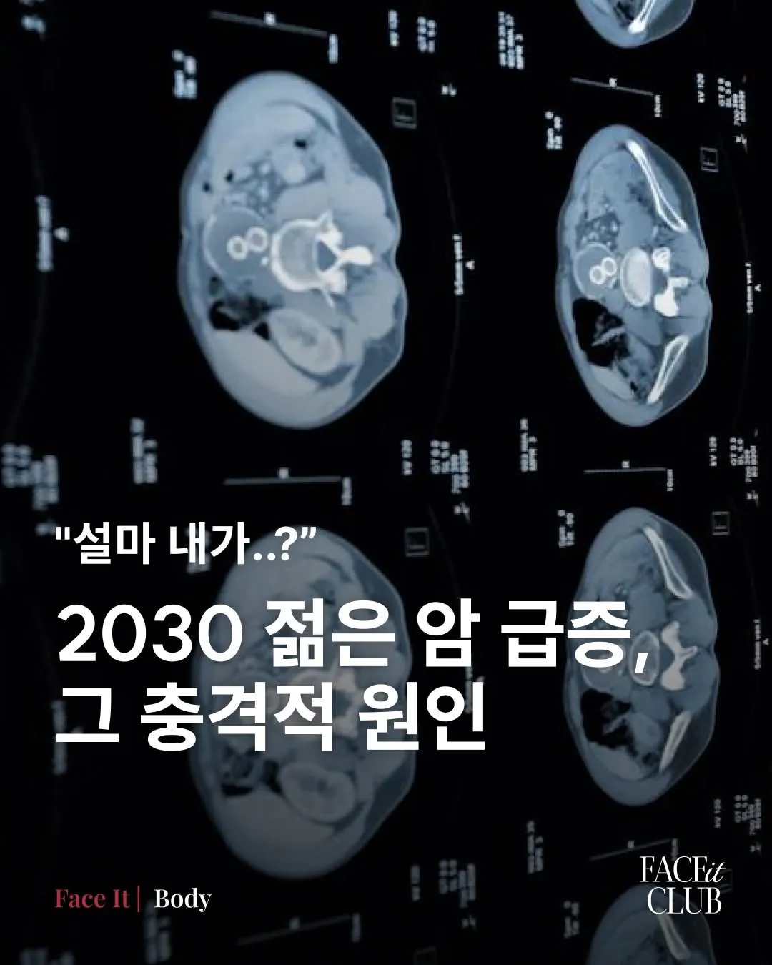 IMG_0392.jpeg 2030 젊은 암 급증, 그 충격적 원인 ㄷㄷㄷㄷㄷ